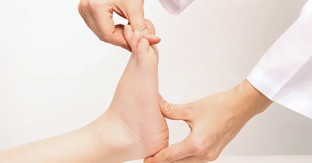 How are flat feet managed